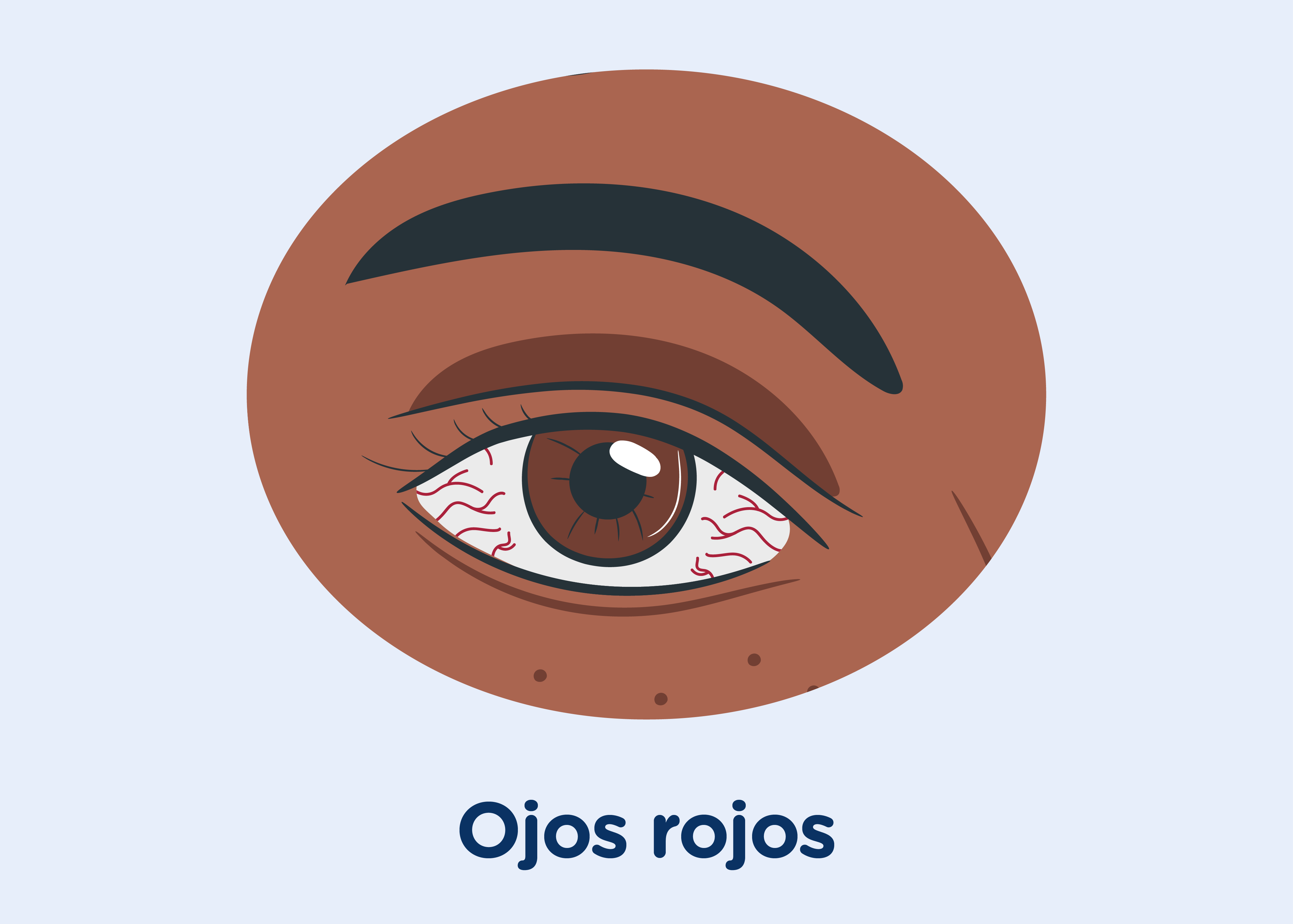 Ojos Rojos